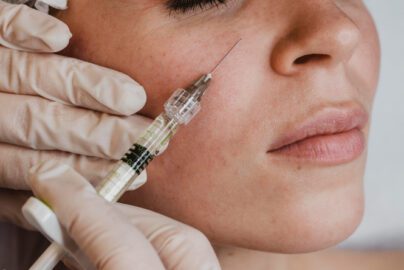 스킨부스터 맞으면