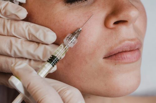 스킨부스터 맞으면